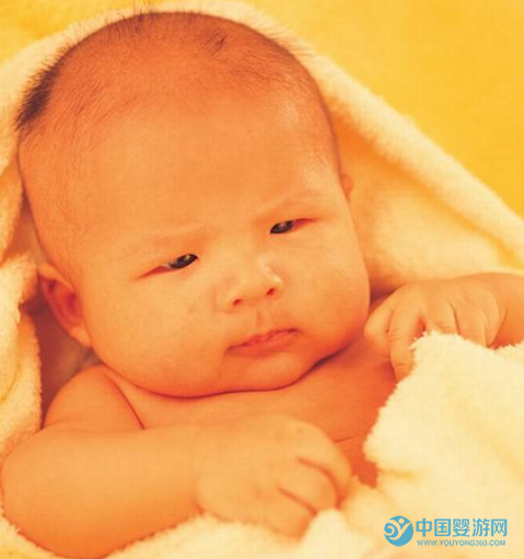 新生儿生理性黄疸和病理性黄疸如何区分：准妈妈的福利5