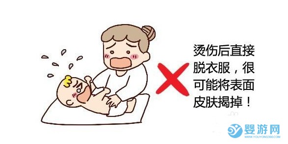 宝宝烫伤五步急救法！家长要知道！ 宝宝烫伤怎么办 宝宝烫伤的急救方法 宝宝烫伤五步急救法