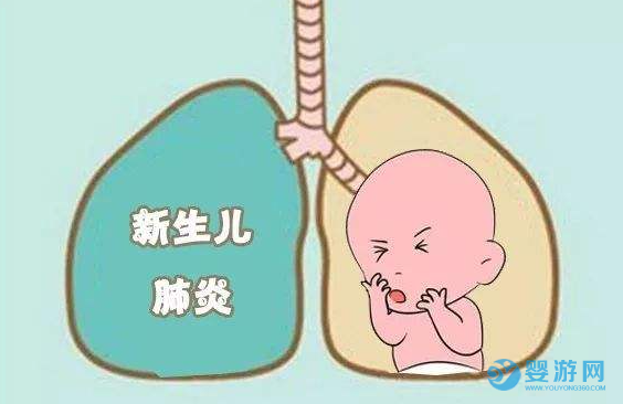 儿童咳嗽是否会发展为肺炎